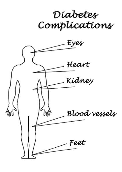 diyabet komplikasyonları