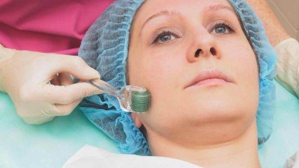 Ιδέες Microneedling Beauty Care