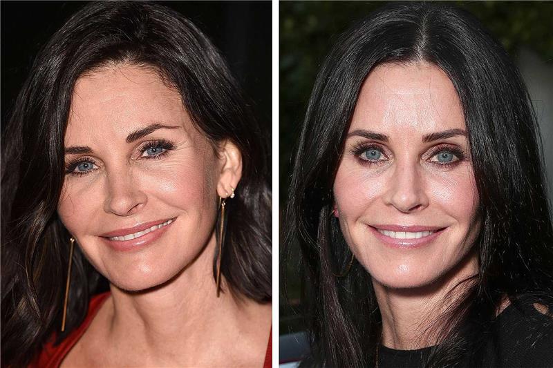 Courteney Cox Operation Beauty op